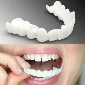 Snap-On Smile